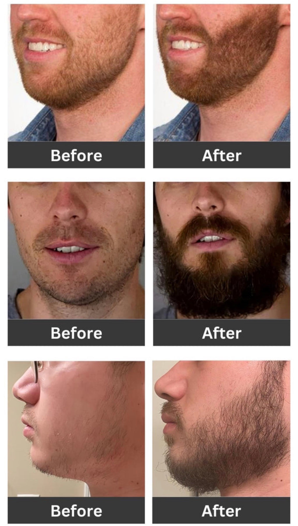 EZZA Hair Growth & Scalp Treatment (Leave-In) | Hair mist