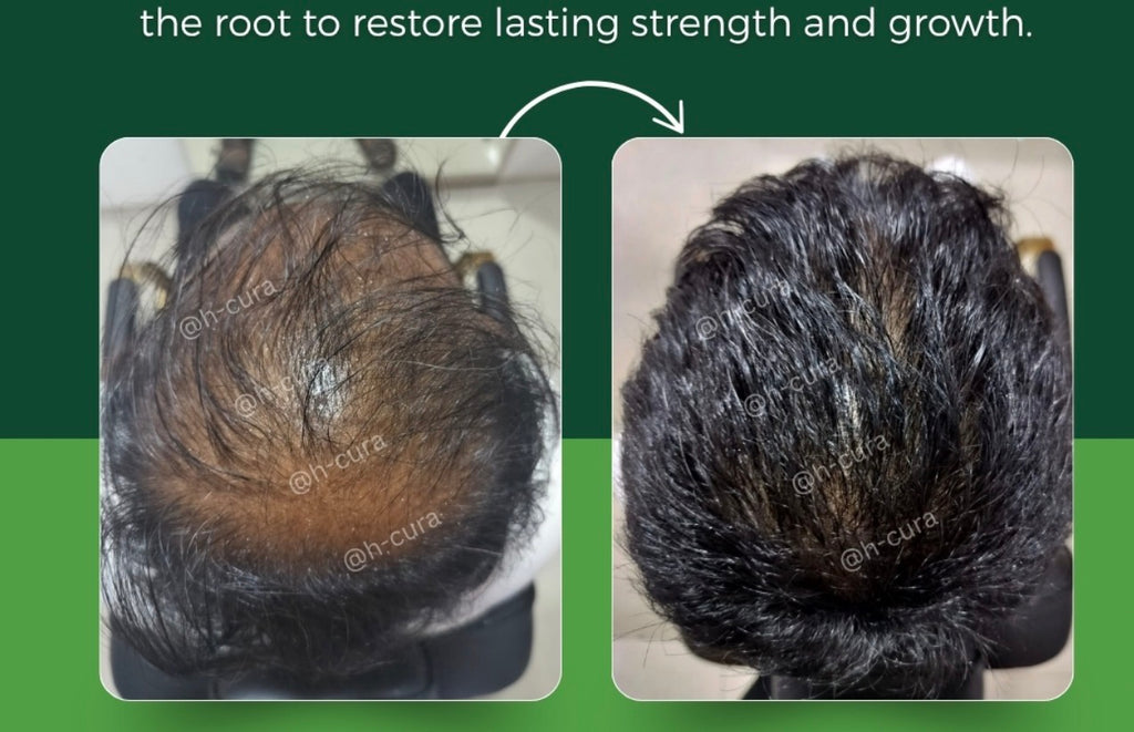 EZZA Hair Growth & Scalp Treatment (Leave-In) | Hair mist