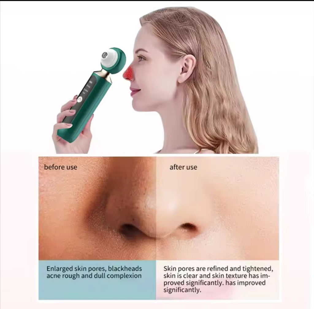 EZZA’s Face Vacuum