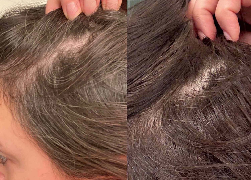 EZZA Hair Growth & Scalp Treatment (Leave-In) | Hair mist
