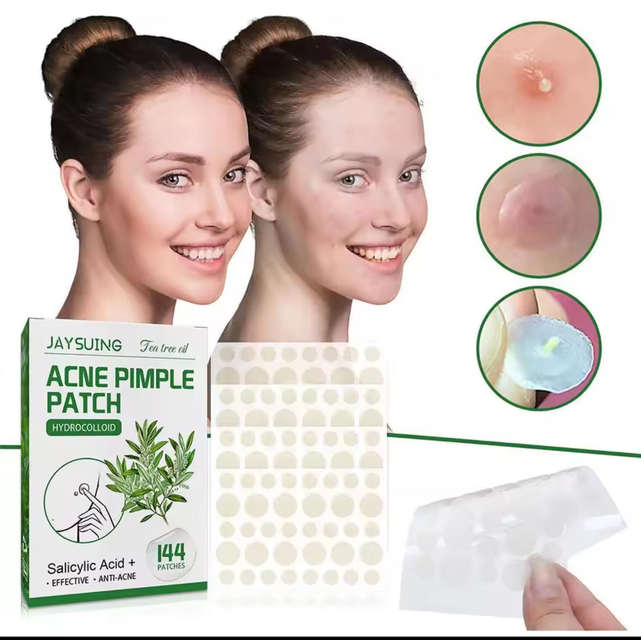 Tea Tree Acne Patch
