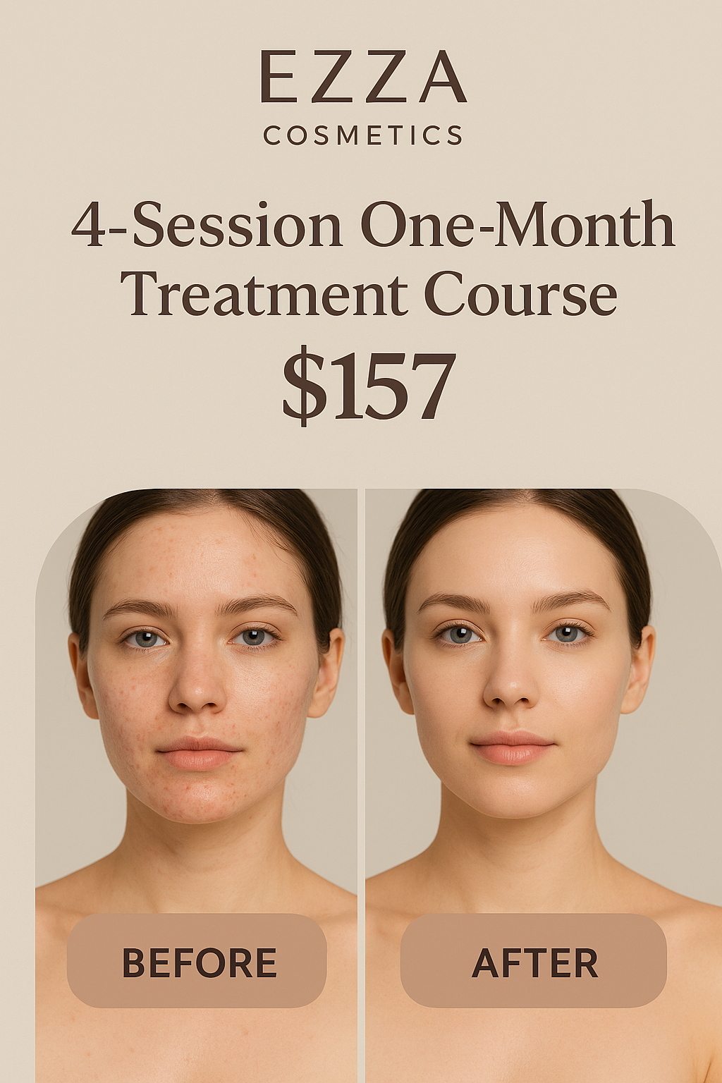 4-Session One-Month Treatment Course