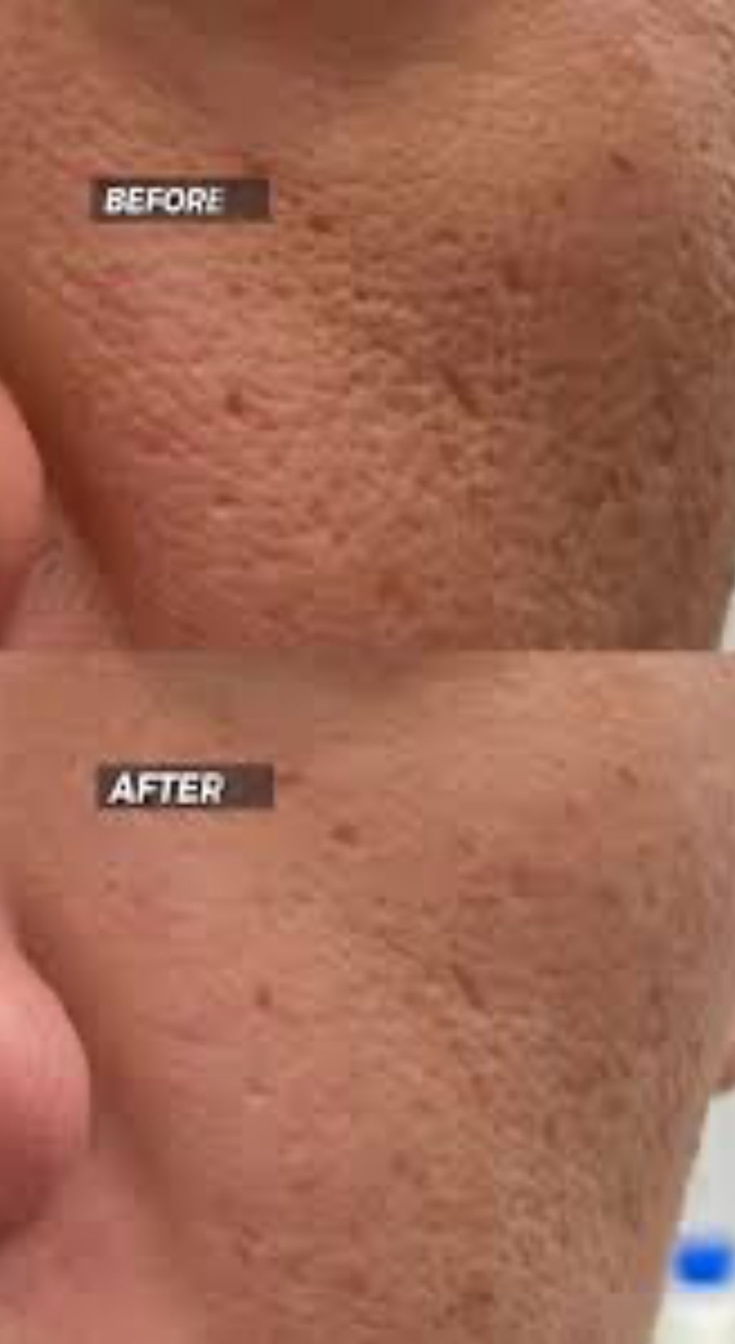 Evergreen Detox Clay Mask – Australian Made | Pores Minimiser, Glow booster & Deep Cleanser