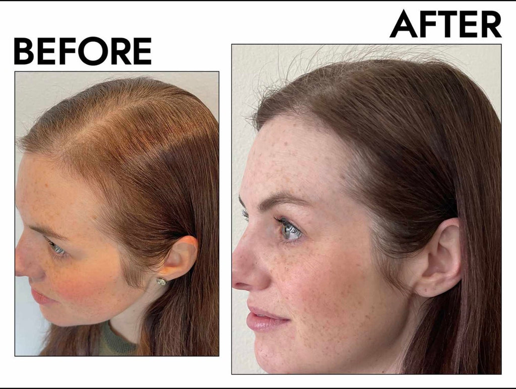EZZA Hair Growth & Scalp Treatment (Leave-In) | Hair mist
