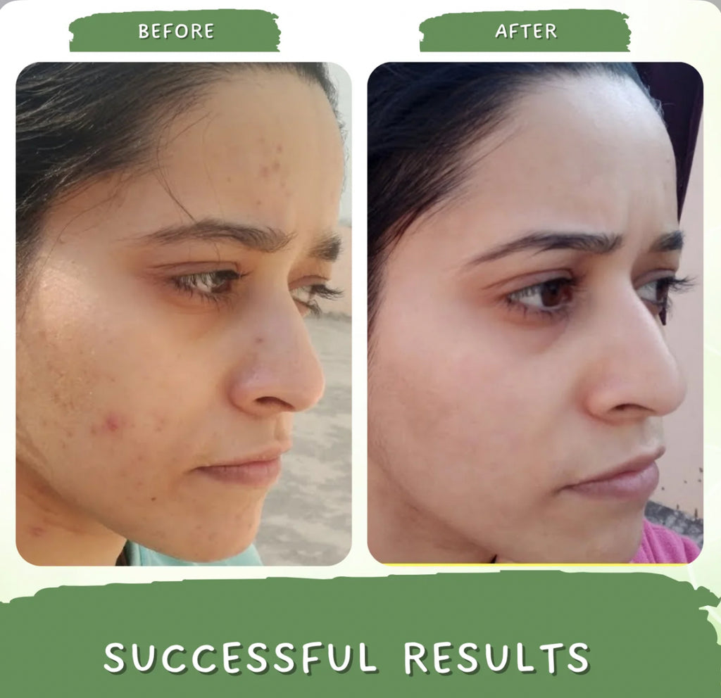 Evergreen Detox Clay Mask – Australian Made | Pores Minimiser, Glow booster & Deep Cleanser