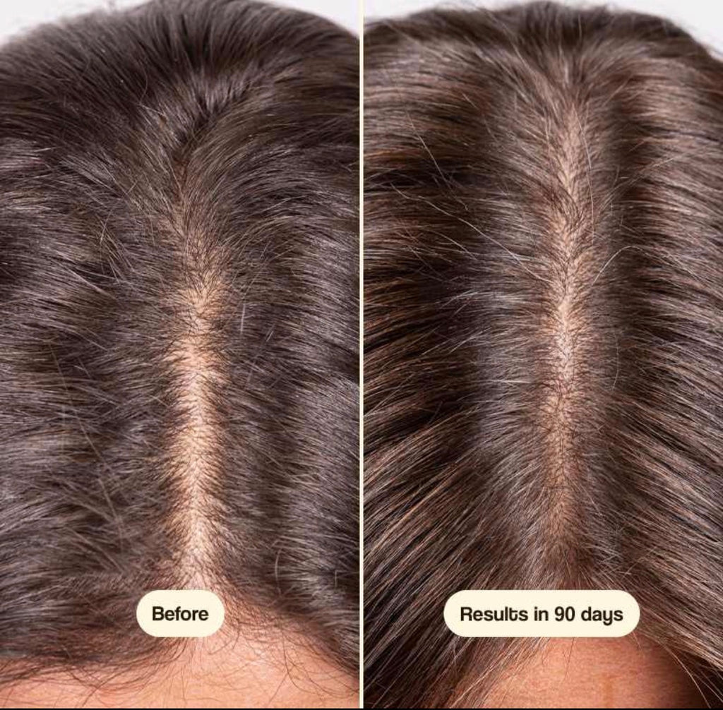EZZA Hair Growth & Scalp Treatment (Leave-In) | Hair mist