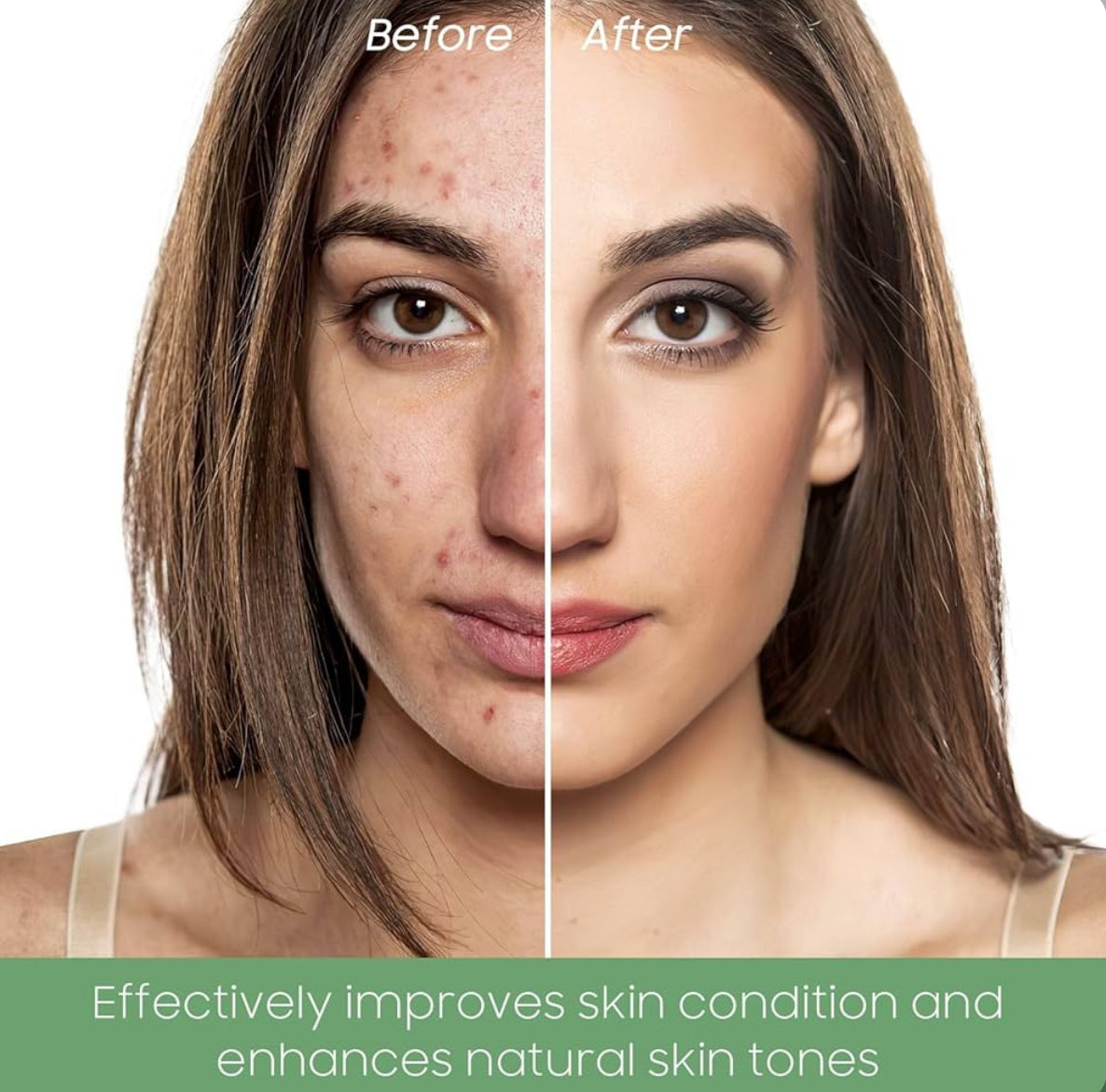 Evergreen Detox Clay Mask – Australian Made | Pores Minimiser, Glow booster & Deep Cleanser