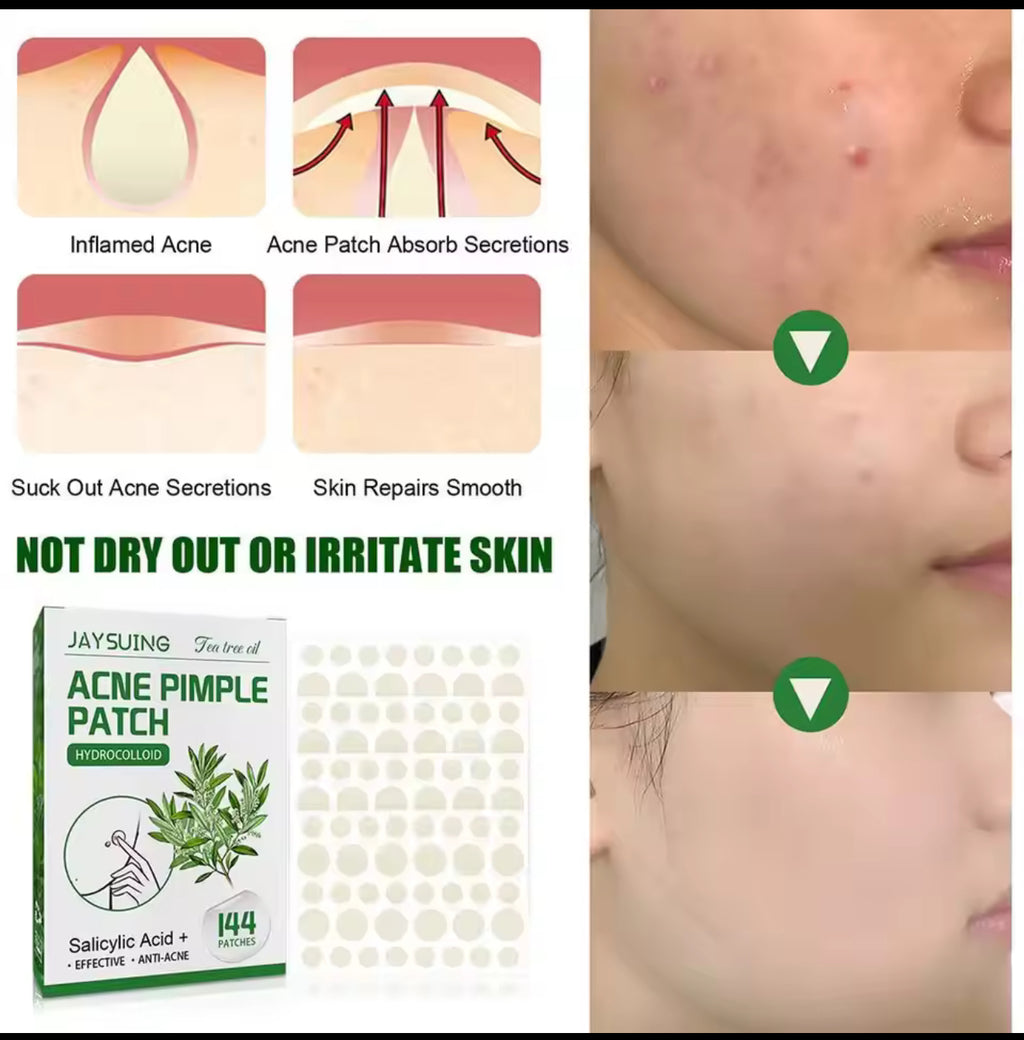 Tea Tree Acne Patch