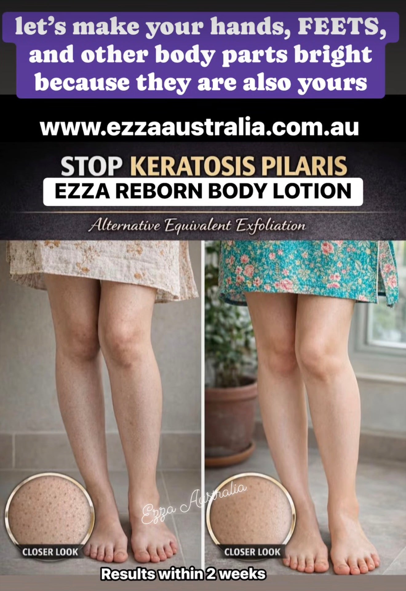 Ezza Glycolic Reborn Body Lotion | hands and feet’s Brightening time
