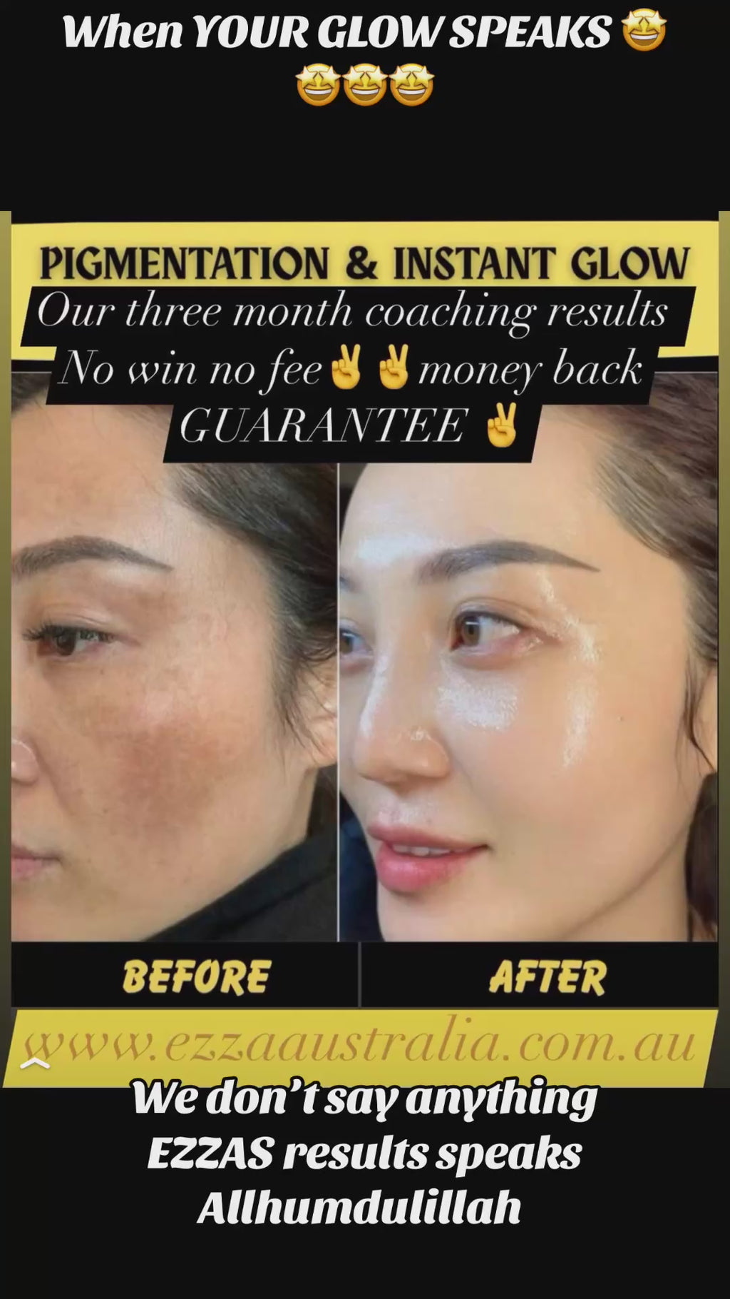 Total Skin Repair Protocol transformation – %100 Results Guaranteed+ Advanced Skin Correction Program (Results or Refund) 3 months - 24 hours access.